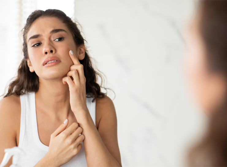 ¿Cómo saber cuál es el tratamiento para el acné que mejor se adapta a tu piel?